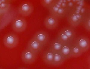 Streptococcus pyogenes 10 в 6