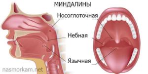 Увеличилась язычная миндалина и белая шишечка на ней