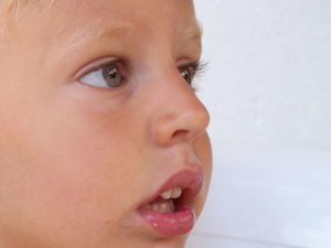 Ребенок дышит исключительно ртом уже около года