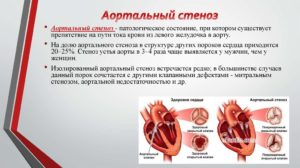 Склеротические изменения стенок МК, АОК.