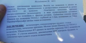 Помогите разобраться с КТ результатом