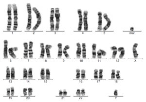 47 хромосом и маркерная