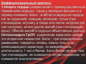 Болит сердце или невроз