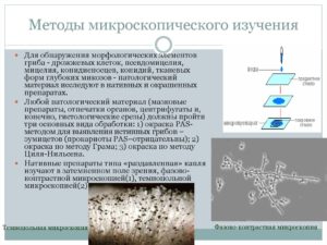 Элементы патологического гриба