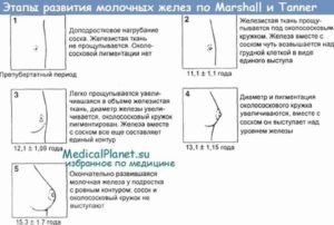 Перестала расти грудь в 12 лет