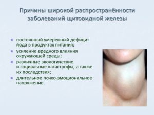 Изменения в щитовидной железе, гиповолюмия