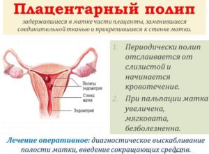 Замершая беременность плацентарный полип