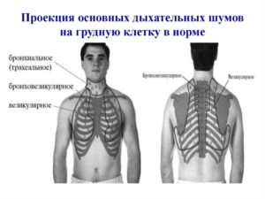 Звук шипения в груди при движении плечей или грудной клетки