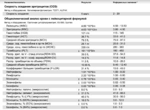 ОАК: повышенное СОЭ 25