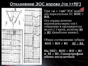 Отклонение ЭОС вправо