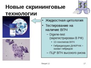 Жидкостная цитология и впч 16