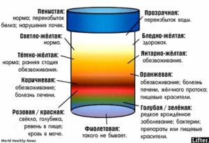 Моча серого цвета