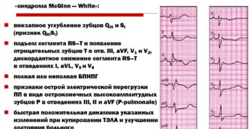 Зачем направляют на ЭКГ после рентгена грудного отдела