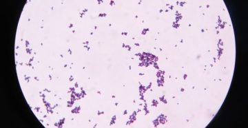 Золотистый стафилококк в мазке