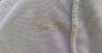 Желто-зеленые выделения у девочки 4 года