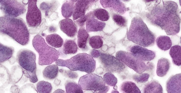 Mycoplasma genitalium