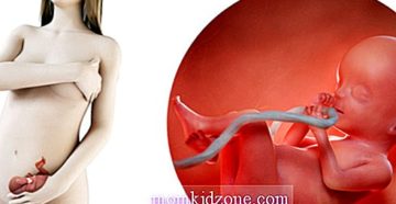 Тошнота на сроке 20 недель беременности