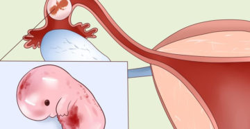 Если пошли месячные значит не беременна?