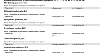 Результат анализа: Ureaplasma parvum, ДНК Метод: Результат положительный(++++)