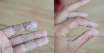 Беспокоят выделения из влагалища на протяжении долгого времени. Беспокоят выделения из влагалища на протяжении долгого времени.