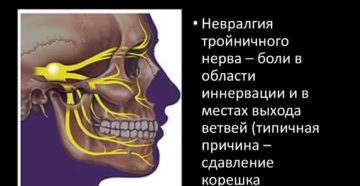 Данные симптомы могут указывать на невралгию тройничного нерва?