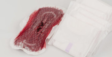 Кровянистые выделения в середине цикла