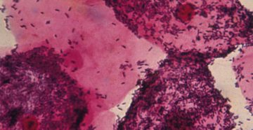 Не могу вылечить гарднереллу Не могу вылечить гарднереллу