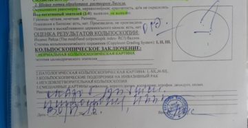 Сколько действительны результаты кольпоскопии? Сколько действительны результаты кольпоскопии?