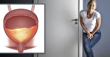 Чувство неполного опорожнения мочевого пузыря