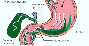 Заброс желчи в желудок