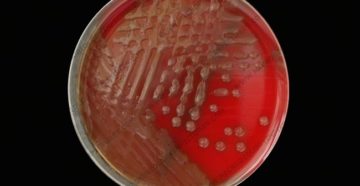 В посеве streptococcus pyogenes