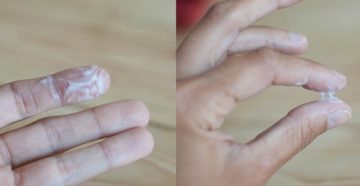 Белые выделения после месячных