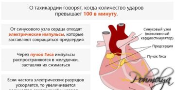 Аритмия и тахикардия после алкоголя