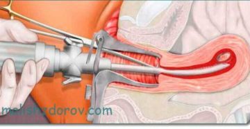 Овуляция после замершей беременности
