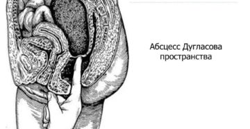 Образование в дугласовом пространстве