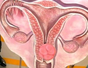 Возможна ли беременность через «трение» гениталий через одежду?