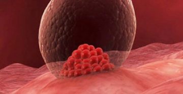 Имплантация эмбриона Имплантация эмбриона