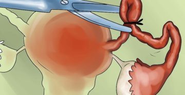 Перевязка труб можно ли сделать эко