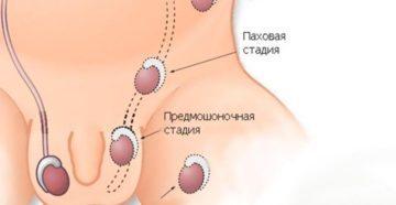 У ребенка пропало яичко