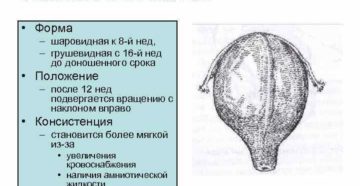 Изменение формы матки Изменение формы матки