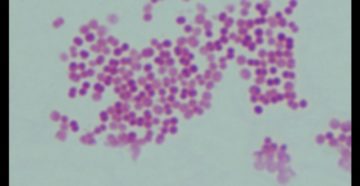 Moraxella_sg_branhamella catarrhalis 3*10^5 и haemophilus influenzae 10^5 у ребенка