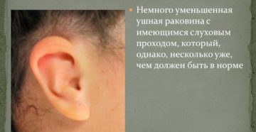 Уменьшается слуховое отверстие в ухе