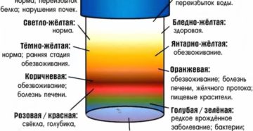 Перед месячными темнеет моча