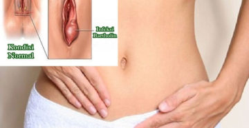 Опухли половые губы и зудят