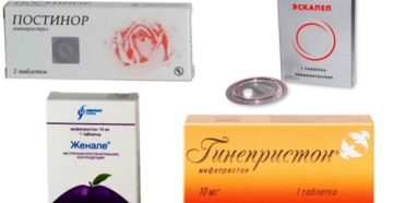 Женале после эскапел