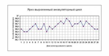 Задержка при ановуляторном цикле Задержка при ановуляторном цикле