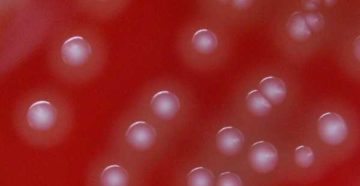 Streptococcus pyogenes 10 в 6