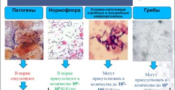 Урогенитальный тракт