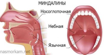 Увеличилась язычная миндалина и белая шишечка на ней