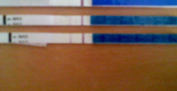 Болит низ живота, болит грудь, белые выделения Болит низ живота, болит грудь, белые выделения